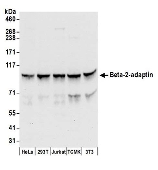 Rabbit Beta-2-adaptin Antibody