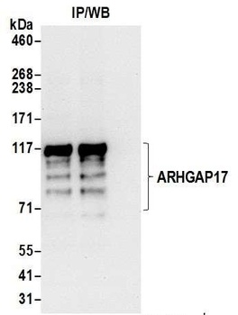 Rabbit ARHGAP17 Antibody