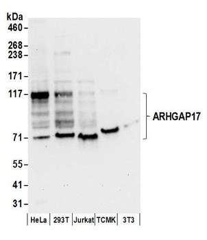 Rabbit ARHGAP17 Antibody