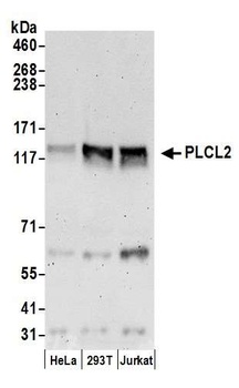Rabbit PLCL2 Antibody