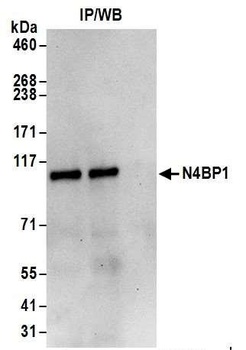 Rabbit N4BP1 Antibody
