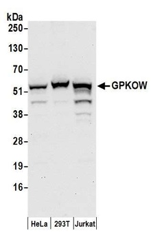 Rabbit GPKOW Antibody
