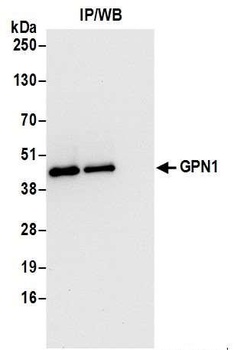 Rabbit GPN1 Antibody