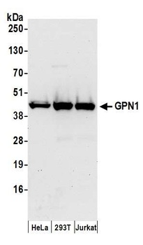 Rabbit GPN1 Antibody