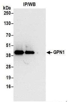 Rabbit GPN1 Antibody