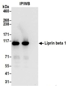Rabbit Liprin beta 1 Antibody