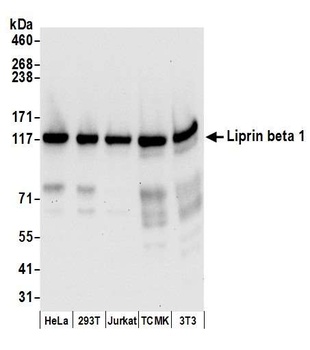 Rabbit Liprin beta 1 Antibody