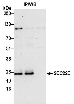 Rabbit SEC22B Antibody