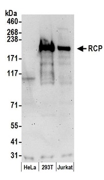Rabbit RCP Antibody