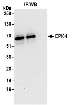 Rabbit EPI64 Antibody