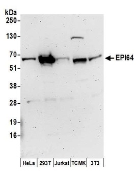 Rabbit EPI64 Antibody