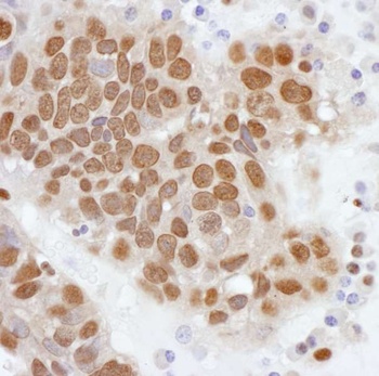 Rabbit PCYT1A Antibody