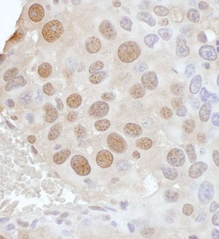 Rabbit PCYT1A Antibody
