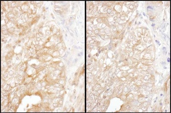 Rabbit DYNC1I2 Antibody