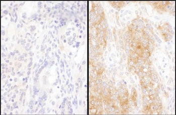 Rabbit DYNC1I2 Antibody