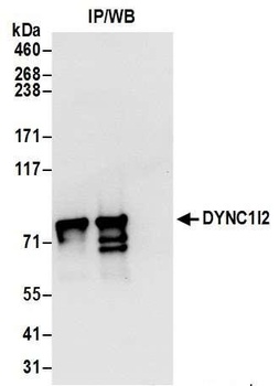 Rabbit DYNC1I2 Antibody