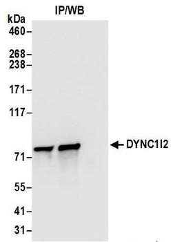 Rabbit DYNC1I2 Antibody