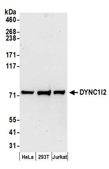Rabbit DYNC1I2 Antibody