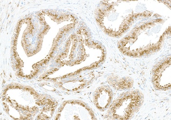 Rabbit COPB2 Antibody