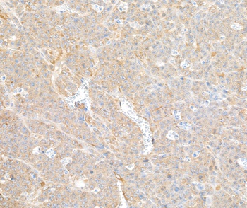 Rabbit COPB2 Antibody