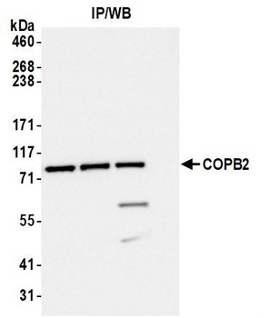 Rabbit COPB2 Antibody