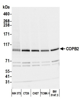 Rabbit COPB2 Antibody