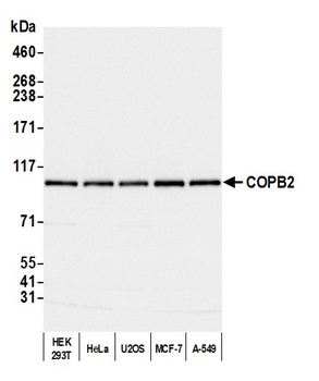 Rabbit COPB2 Antibody