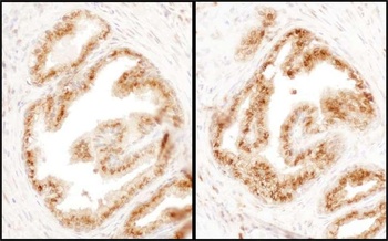 Rabbit COPB2 Antibody