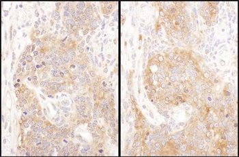 Rabbit COPB2 Antibody