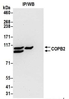 Rabbit COPB2 Antibody