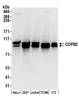 Rabbit COPB2 Antibody