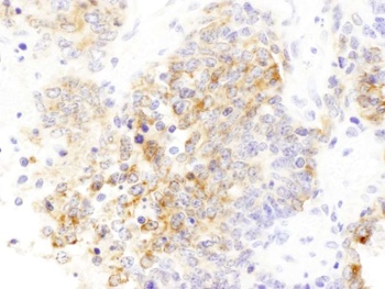 Rabbit Drebrin Antibody