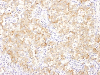 Rabbit Drebrin Antibody