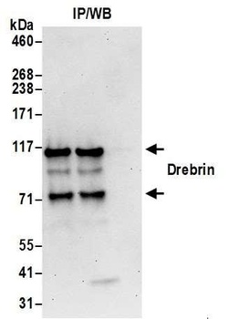Rabbit Drebrin Antibody