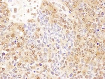 Rabbit P23 Antibody