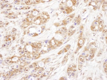 Rabbit P23 Antibody