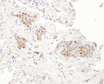 Rabbit P23 Antibody