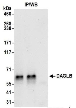 Rabbit DAGLB Antibody