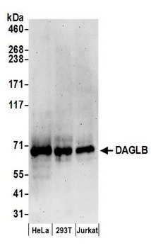 Rabbit DAGLB Antibody