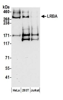 Rabbit LRBA Antibody