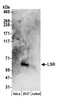 Rabbit LSR Antibody