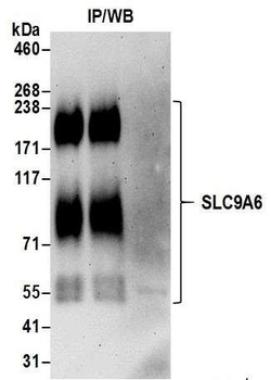 Rabbit SLC9A6 Antibody