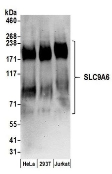 Rabbit SLC9A6 Antibody