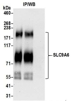 Rabbit SLC9A6 Antibody