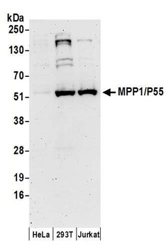 Rabbit MPP1/P55 Antibody