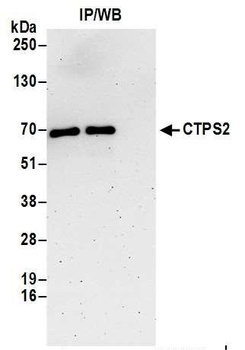 Rabbit CTPS2 Antibody