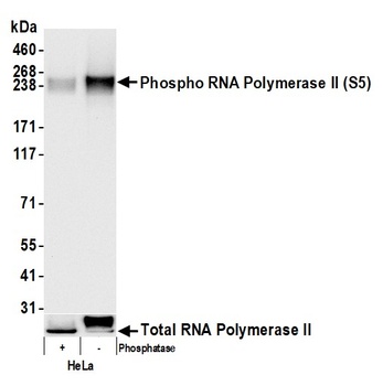 Rabbit RNA Polymerase II, Phospho (S5) Antibody