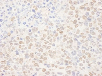 Rabbit NAT10 Antibody
