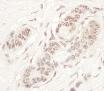 Rabbit NAT10 Antibody