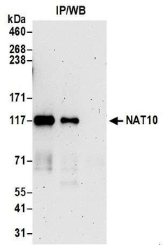 Rabbit NAT10 Antibody
